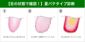 夏バテ気味のあなた 自分の舌を観察してみよう 漢方の千幸堂薬局 広島市